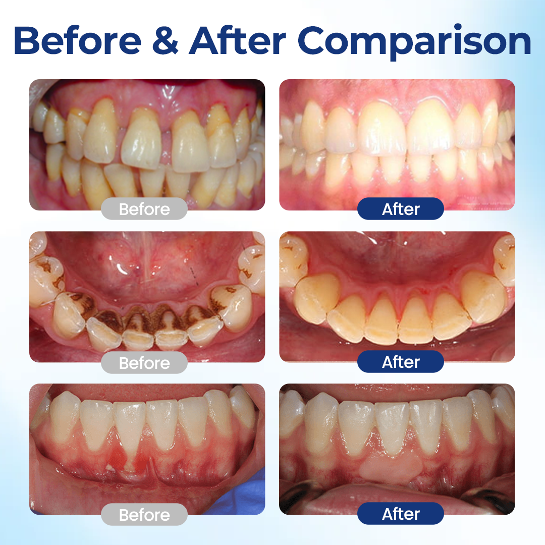 Biancat® BeeTakt Oral Repair Solution